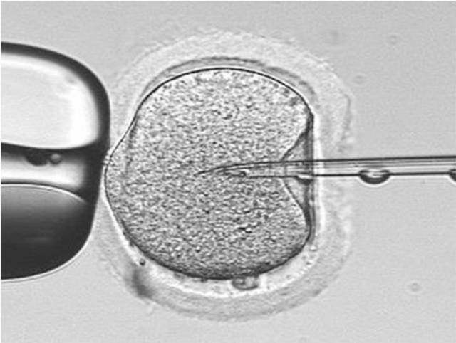 卵胞浆内单精子显微注射技术