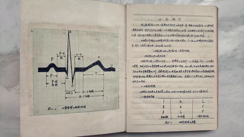 从这时起,具有探索思维的我从心眼里喜欢,热爱上了心电图