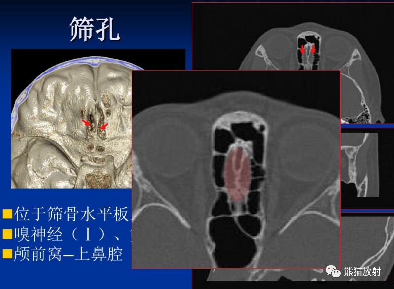 解剖丨颅底孔道及内容物