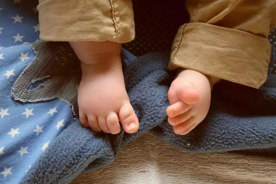 专家在线丨宝宝是不是"内八字"脚?看完这个你就全明白