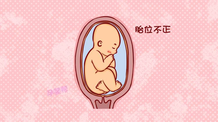 母婴 正文  在孕妈怀孕30周之后,胎儿在正常情况下,在母亲肚子里面是