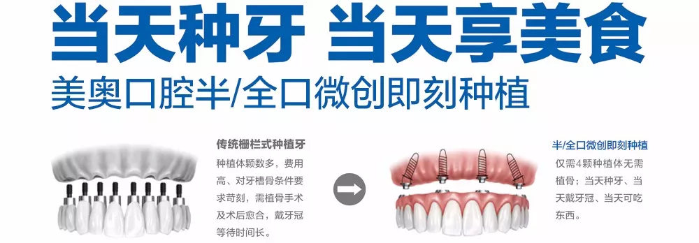 宝威体育官网：宝威体育下载网站：费用有望减半！山东4月起实施新版植牙服务项目及价格