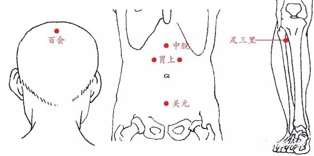 胃下垂的艾灸疗法，说明详细一学就会！ .艾灸养生