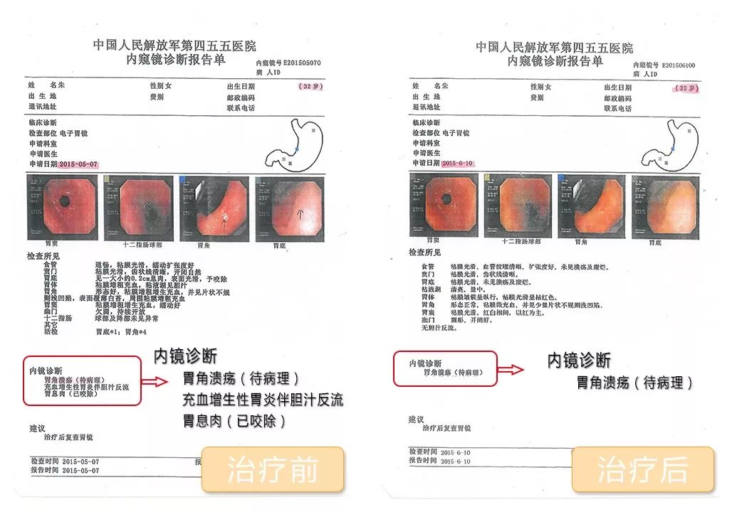 好物推荐:学好语文必备的《藏在地图里的古诗词》&让你远离幽门螺旋