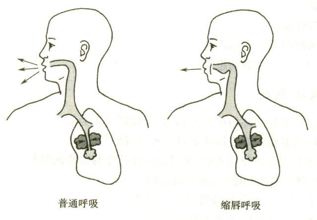 体育 正文  通过增强呼吸功能的锻炼,能够有效加强患者膈肌运动,提高