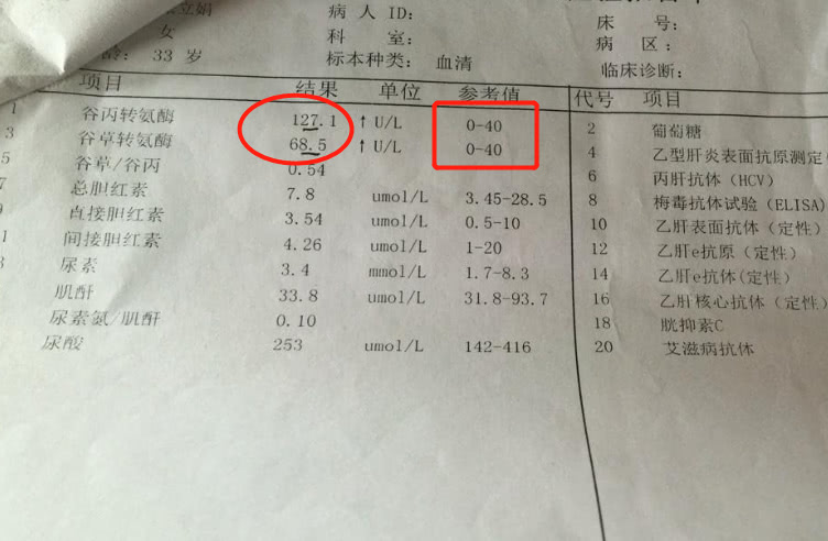 转氨酶高于80,说明肝炎恶化,做到3点降酶,不怕肝癌找