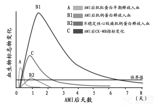 新闻   图 1 不同心肌酶指标在心肌损伤时的变化曲线 ctn 在发病 3～4