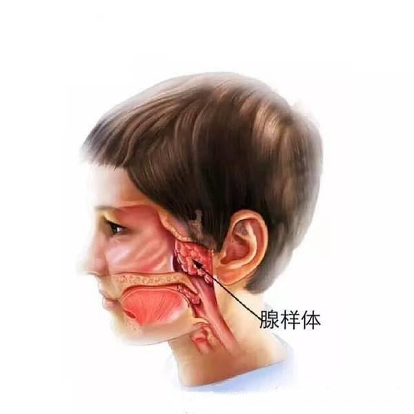 小儿腺样体肥大症状:石萍:小儿腺样体肥大症状不可不知