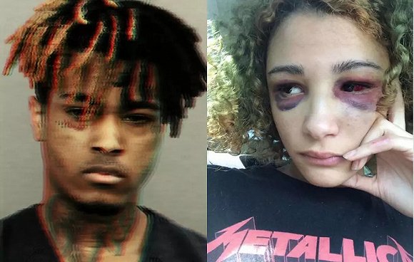 xxxtentacion(左)否认施暴,并坚称前女友当时根本没怀孕