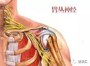 【臂丛神经】康复专家总结——臂丛神经损伤的治疗
