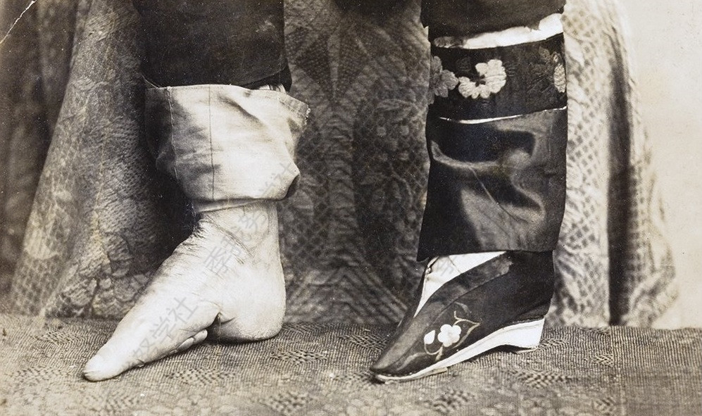 1880-1910年间,裹脚女性脚部的照片.
