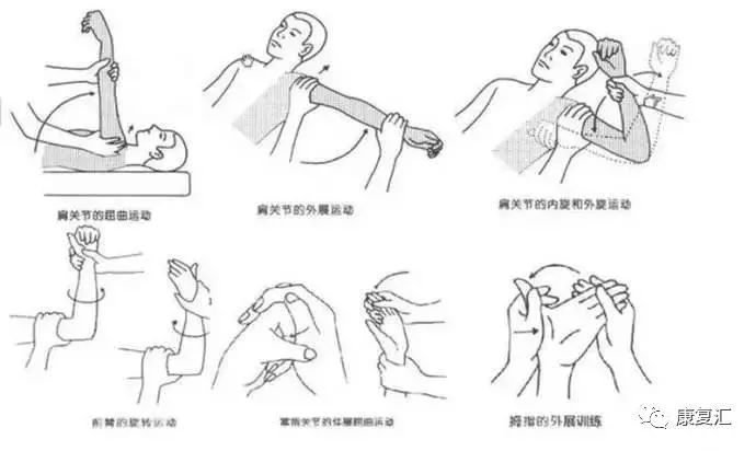 入门到精通脑卒中康复治疗方案全套训练方案