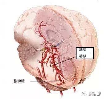 图解脑供血系统之脑动脉