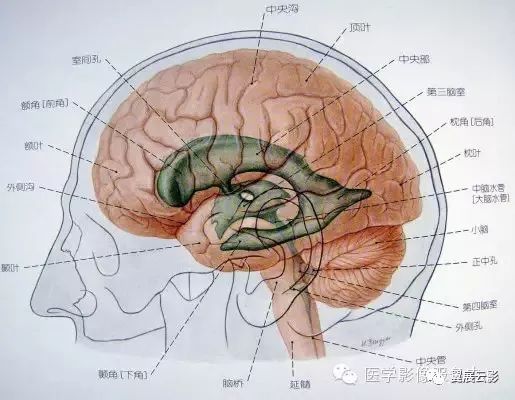 第五脑室,第六脑室以及中间帆腔(图文详解)