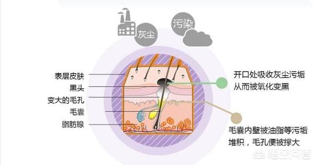 鼻子毛孔怎么办