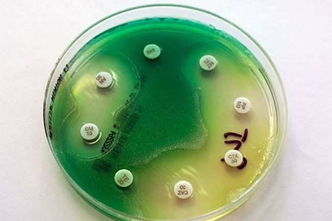 10. 铜绿假单胞菌