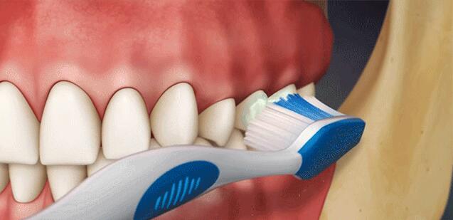【正确的刷牙方法】刷牙时牙龈出血是怎么回事_刷牙的正确时间