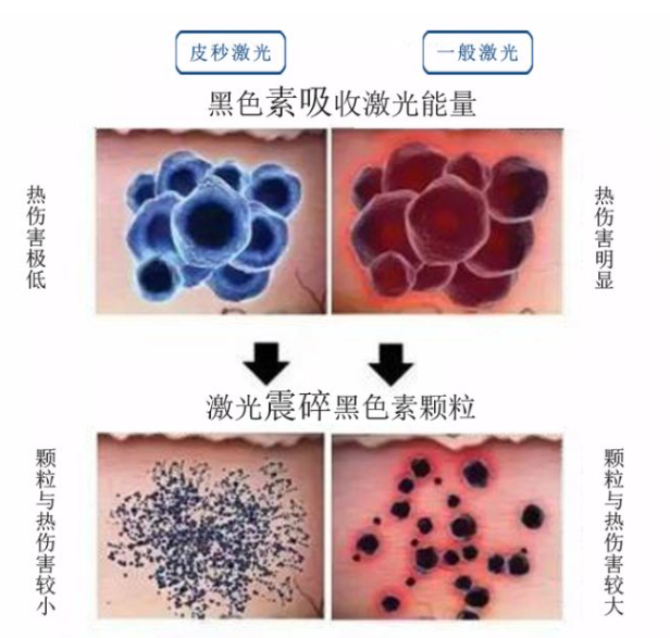 皮秒激光的原理和作用_皮秒激光切割玻璃的原理和工艺研究(2)