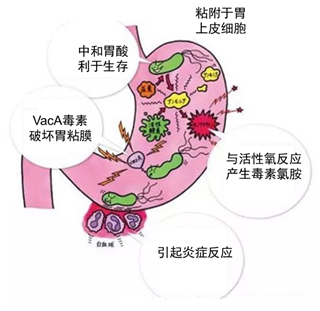 幽门螺旋杆菌致病机制