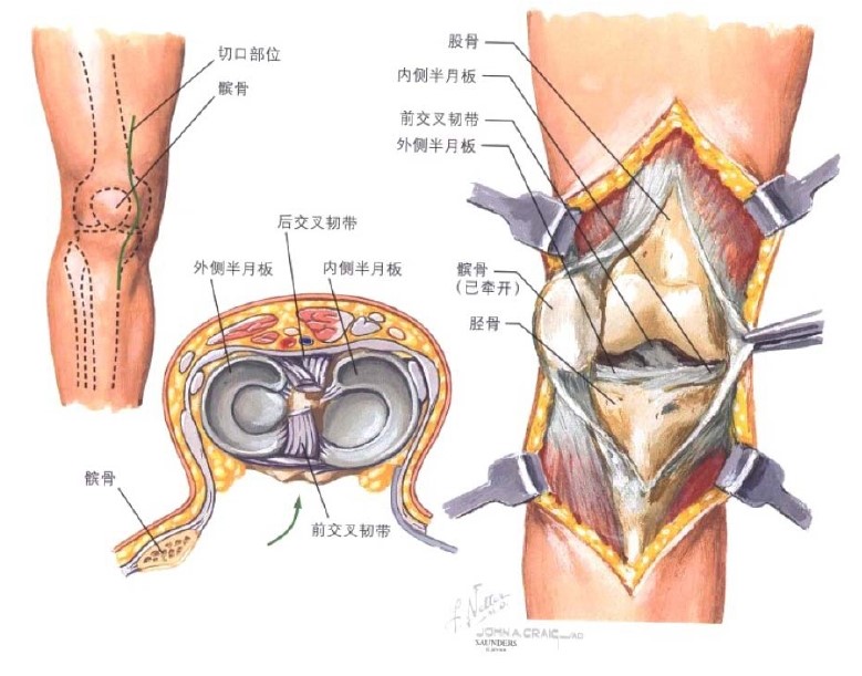 健康 正文  膝关节是下肢重要的负重关节,其结构和功能是人体关节中最