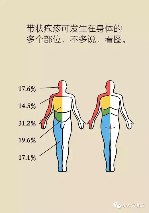 协和专家教您搞定带状疱疹