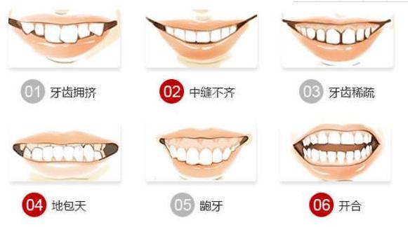 牙齿畸形还是比较常见的,但是有许多人认为牙齿不整齐是一个非常正常