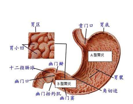 慢性肠胃炎有什么症状