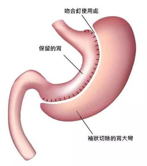 胃的原理是什么_胃左边是什么器官(3)