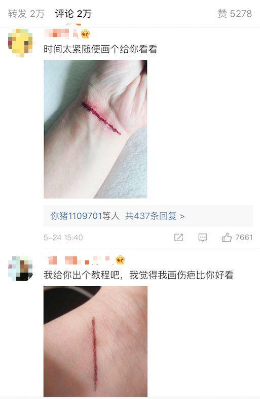 黑子冒充粉丝直播假割腕,这是什么仇