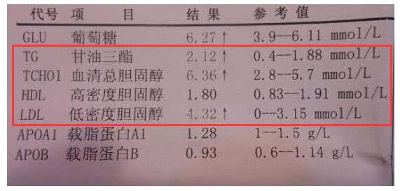 这些食物是甘油三酯的克星常吃告别高血脂让血管一通到底