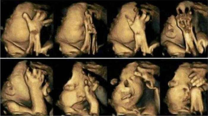 抽烟孕妇的胎儿图