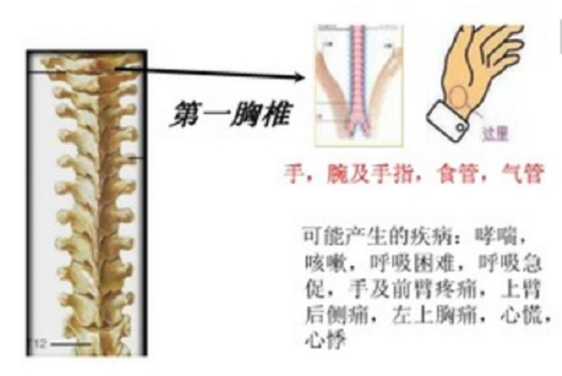 骨质增生的直接压迫,损害了神经根(前根中含交感节前纤维),脊髓(胸椎