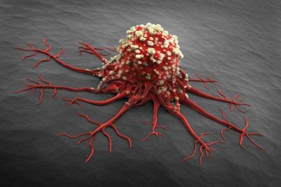 健康 正文  癌症是什么: 癌症是人体细胞在复制过程中dna出现错误突变