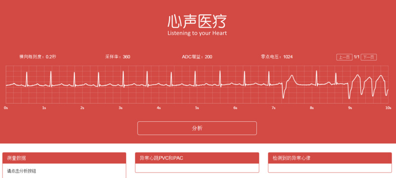 当ai遇上心电图,「心声医疗」帮医生自动生成诊断报告