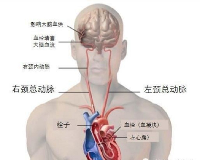 有血栓的人口比例_腿上有血栓真人图片