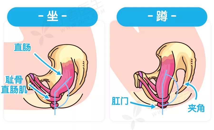 图片来源:丁香医生设计团队 蹲便时,耻骨直肠肌完全放松,肛门和直肠