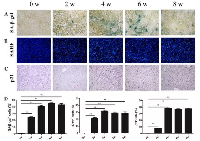 通过观察细胞衰老的三个特征(β-半乳糖苷酶活性,sahf形成以及p21的