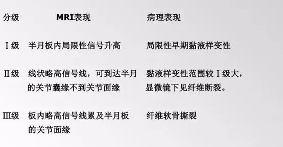 x线摄片:检查目的不是为了诊断半月板撕裂,而是排除骨软骨游离体,剥脱