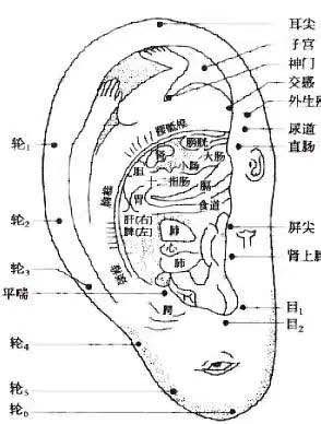 科普耳朵上贴东西治病这是耳穴埋豆