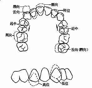 无论你的牙齿是骨性还是牙性,是选择传统托槽还是隐形矫正技术,一定要