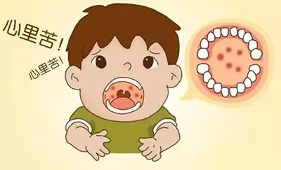 口腔内的疱疹是最重要的鉴别点.