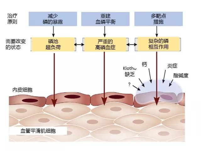 3图读懂慢性肾脏病患者高磷血症的危害与治疗