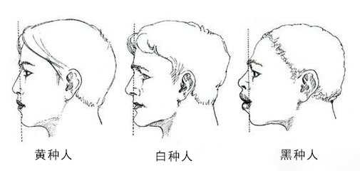 一颗龅牙怎么办