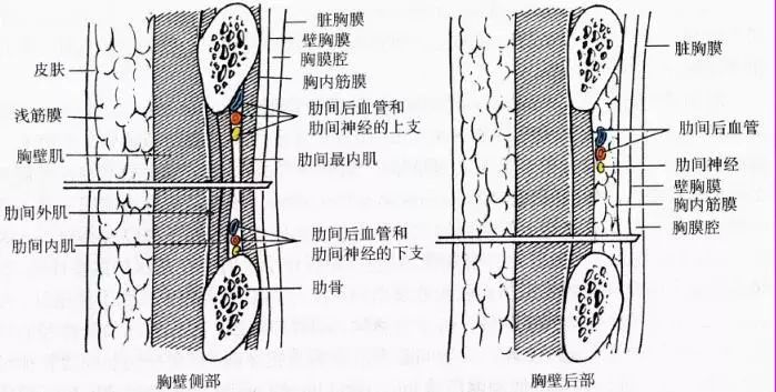 大家都知道,胸腔穿刺一般选择后肋,在下位肋骨的上缘进针,避免损伤