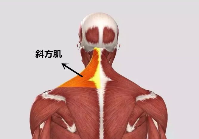 后天的溜肩,主要是由于连接肩部与脖子的斜方肌过于发达导