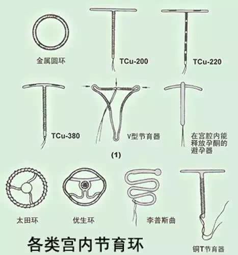 带环避孕的原理是什么_\