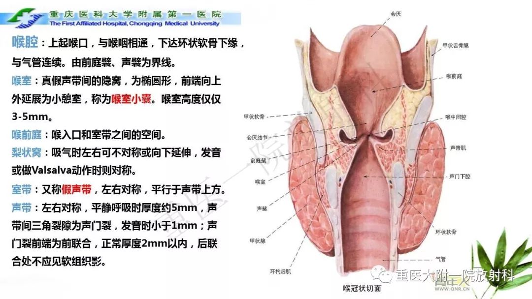 喉部解剖及t分期影像诊断