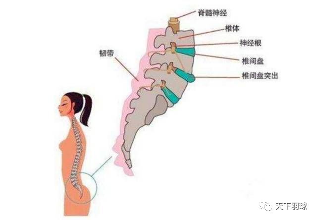 打羽毛球,腰肌劳损的症状和预防