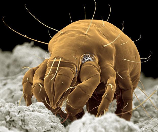 实拍:日常家居普遍存在的虫子,放大一百万倍后,看起来