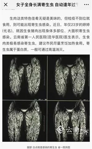 华西专家说 不要切ju小龙虾脑壳头的汤汤 爆笑方言教你吃虾不长虫